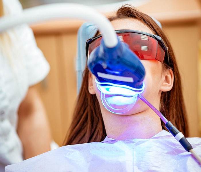 Laser Teeth Whitening in Masset Laser Teeth Whitening in Masset