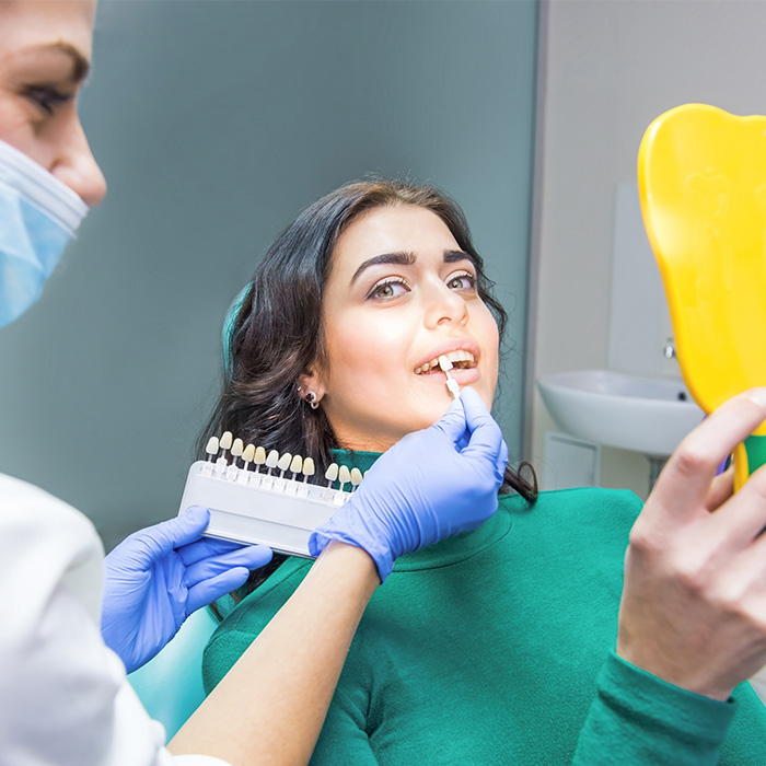 masset veneers at greenwoods