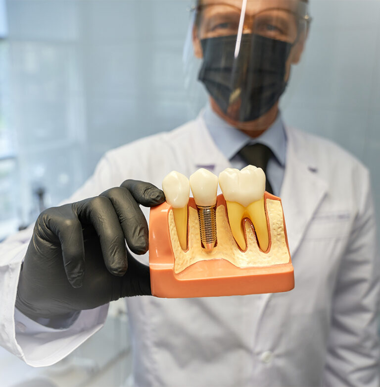 Dental Implants in Masset — Permanent Tooth Replacement in Haida Gwaii